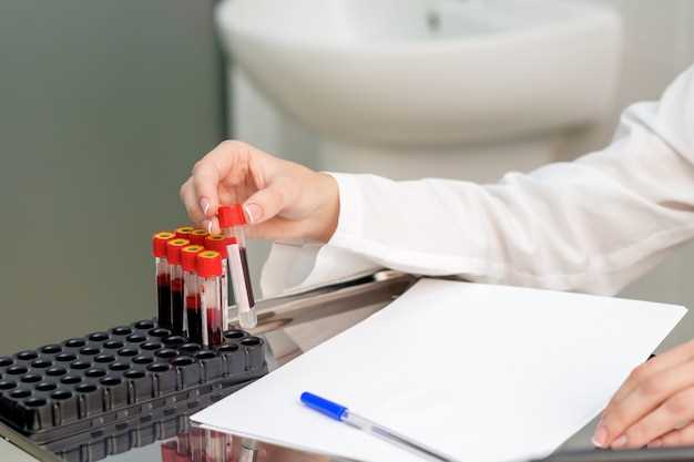 Что такое анализ на сгущение крови?