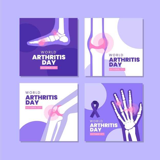 Основные принципы лечения артрита и артроза
