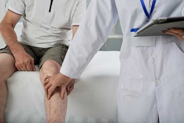 2 степень доа коленного сустава: лечение и реабилитация