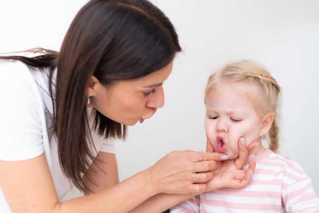 Симптомы герпеса на языке у ребенка