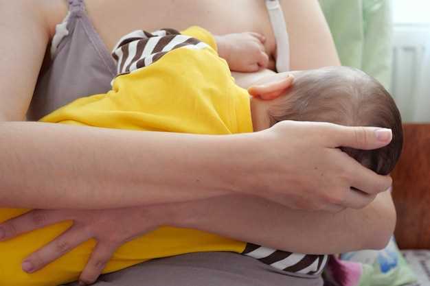 Причины возникновения желтухи у младенцев