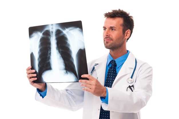 Туберкулез - опасное инфекционное заболевание